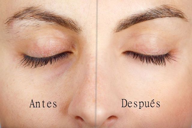 Limpieza de cutis antes o despues de la depilacion